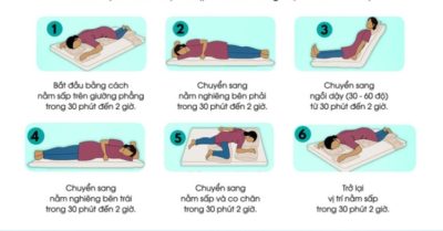 Hướng dẫn tư thế nằm giúp cải thiện oxy phổi cho bệnh nhân F0 được chăm sóc tại nhà