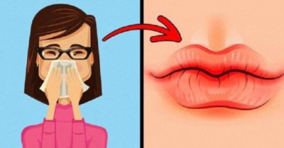 Mẹo nhìn màu sắc môi có thể biết được tình trạng sức khỏe