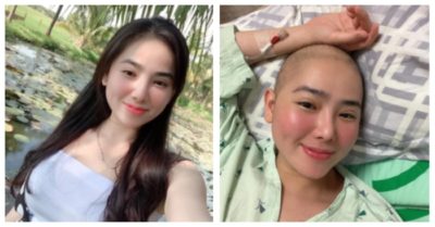 Cô gái mắc ung thư ở tuổi 28: Hối hận vì từng nhậu nhẹt thâu đêm, đổ bệnh mới thấy tiền không quan trọng