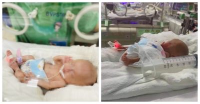 Kỳ tích: Em bé nhẹ cân nhất Việt Nam chào đời