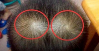 Người có 2 xoáy tóc: Mang số đào hoa, thông minh, giàu có