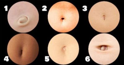 Đoán tính cách qua hình dạng rốn của một người