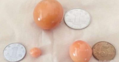 Video: Đổi đời sau một đêm nhờ mua ốc giác vàng chiêu đãi bạn