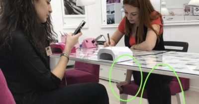 Bức ảnh cô gái có 3 tay và ngược chân gây tranh cãi