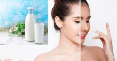 Làm trắng da, xông da mặt cần chú ý những tác hại bên lề