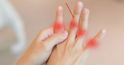 Ngón tay giữa có 4 dấu hiệu này cho thấy gan có vấn đề, nên đi khám ngay