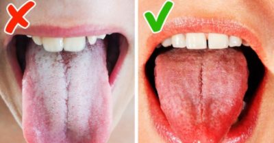 12 biểu hiện trên lưỡi cảnh báo mắc bệnh nguy hiểm, cần lưu ý để bảo vệ sức khỏe