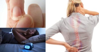 Những dấu hiệu cảnh báo cơ thể đang thiếu Vitamin C trầm trọng