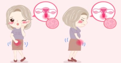 Một số điều phụ nữ cần lưu ý trong ngày kinh nguyệt để tránh mắc bệnh phụ khoa