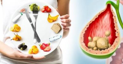 Những quy tắc trong ăn uống để ngăn ngừa sỏi mật hiệu quả