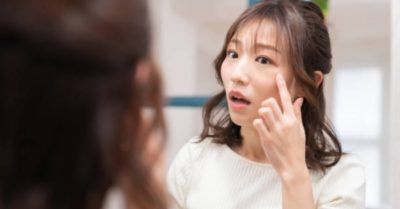 Thời điểm chị em dễ bị nám da nhất trong đời và cách phòng ngừa nám da hiệu quả
