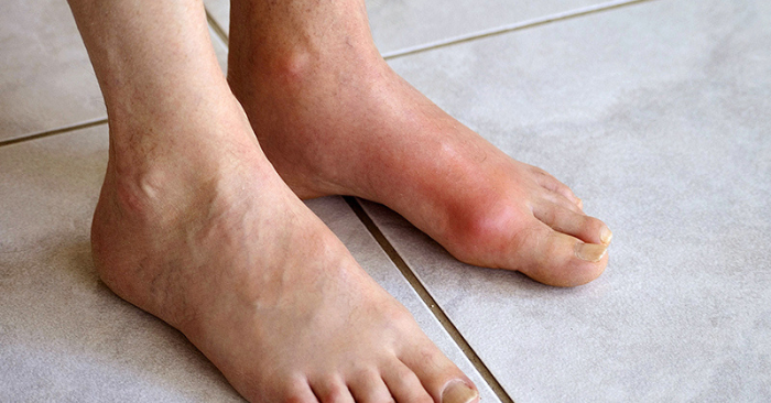 5 người này không nên ăn thịt bò