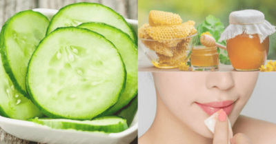 Cách trị môi khô nứt nẻ tại nhà