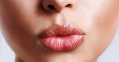 Cách trị môi khô nứt nẻ tại nhà hiệu quả mùa lạnh