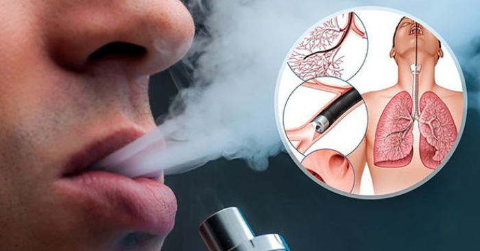 Khói thuốc không có ngưỡng an toàn cho sức khỏe