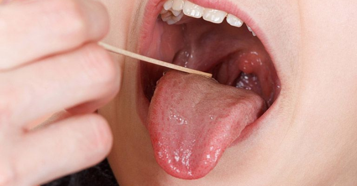 Tại sao cảm lạnh thường bắt đầu từ cổ họng?