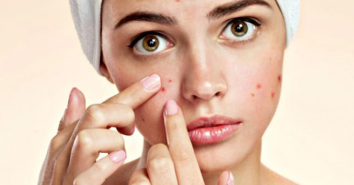 Có nên uống vitamin E khi da dầu nhiều mụn