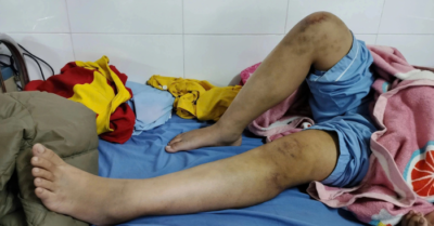 Bé gái 12 tuổi bị bạo hành và hành trình thoát thân