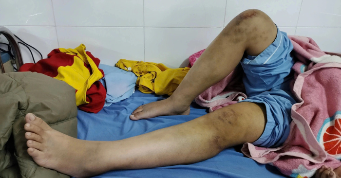 Bé gái 12 tuổi bị bạo hành và hành trình thoát thân