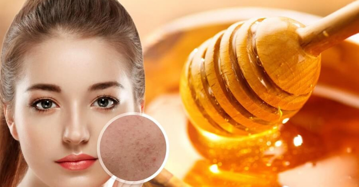 Uống mật ong buổi sáng có lợi gì?