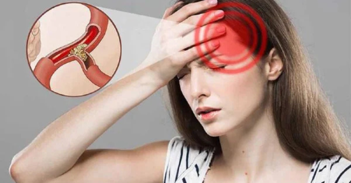 Ngủ đủ giấc nhưng sáng dậy vẫn đau đầu vì đâu?