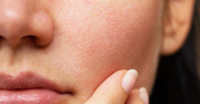 8 thói quen khiến da khô bong tróc vào mùa đông