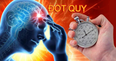 Các thời điểm trong ngày dễ gây đột quỵ nhất