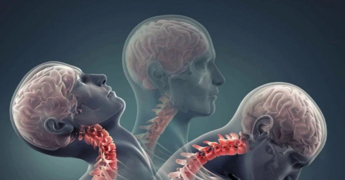 Thói quen bào mòn cột sống cổ của người Việt hiện đại