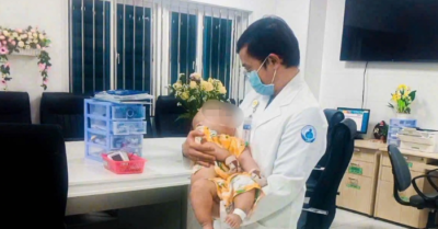 Phẫu thuật thành công khối u não khổng lồ cho bé 7 tháng tuổi