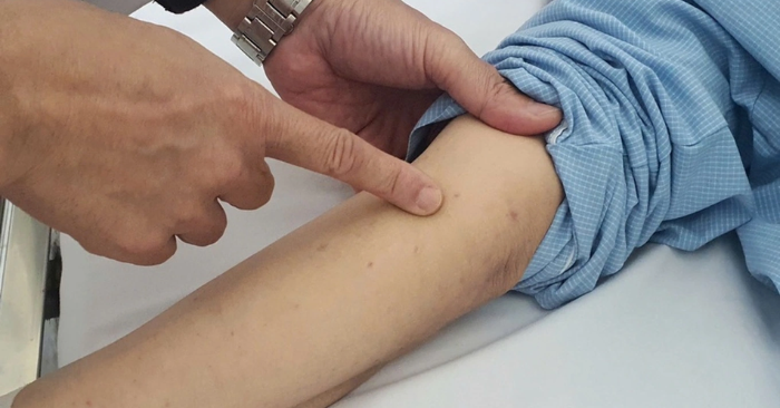 Dịch bệnh truyền nhiễm: Covid-19 và sốt xuất huyết tại Việt Nam tăng mạnh