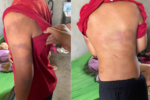 Bạo hành trẻ em: Người mẹ tố cáo cha ruột đánh đập con tại Nghệ An