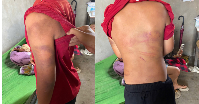 Bạo hành trẻ em: Người mẹ tố cáo cha ruột đánh đập con tại Nghệ An