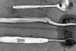 Bệnh viện Việt Đức mổ lấy hai bàn chải và thìa inox trong dạ dày người tự kỷ