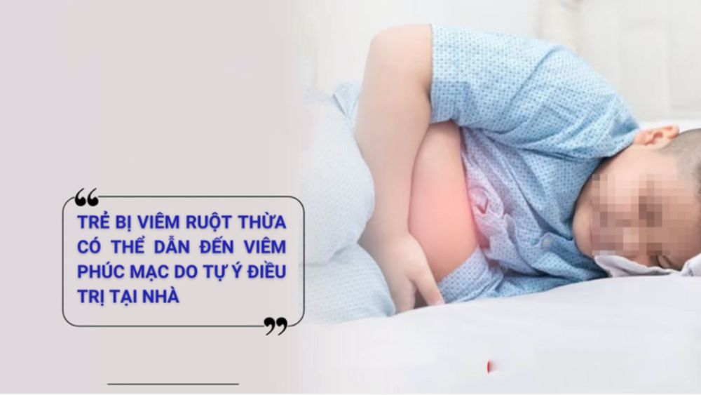 Tự ý chữa đau bụng cho con tại nhà, 3 trẻ bị vỡ ruột thừa dẫn đến viêm phúc mạc cấp cứu. Xem ngay cảnh báo từ bác sĩ để phát hiện kịp thời.